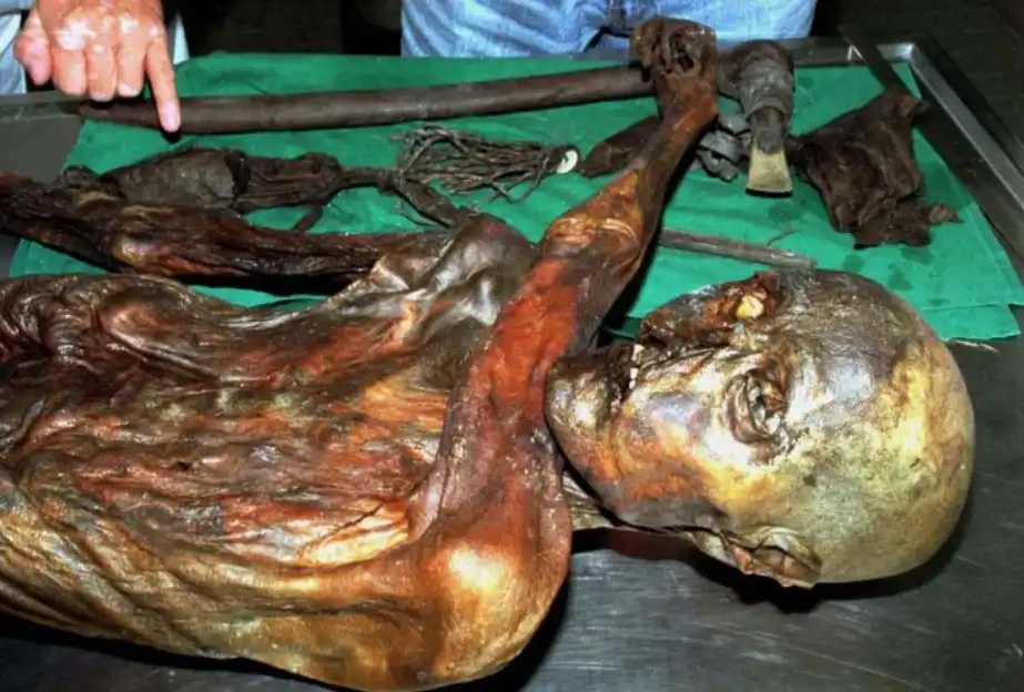 Read more about the article 5300-Year-Old Mummy Practiced Acupressure