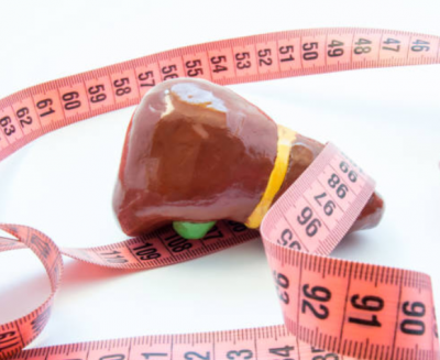 fatty liver fatty liver
